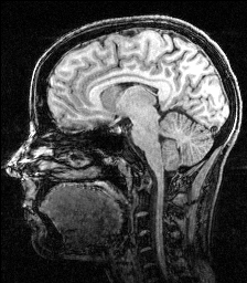 My brain - as taken during a very scary MRI study